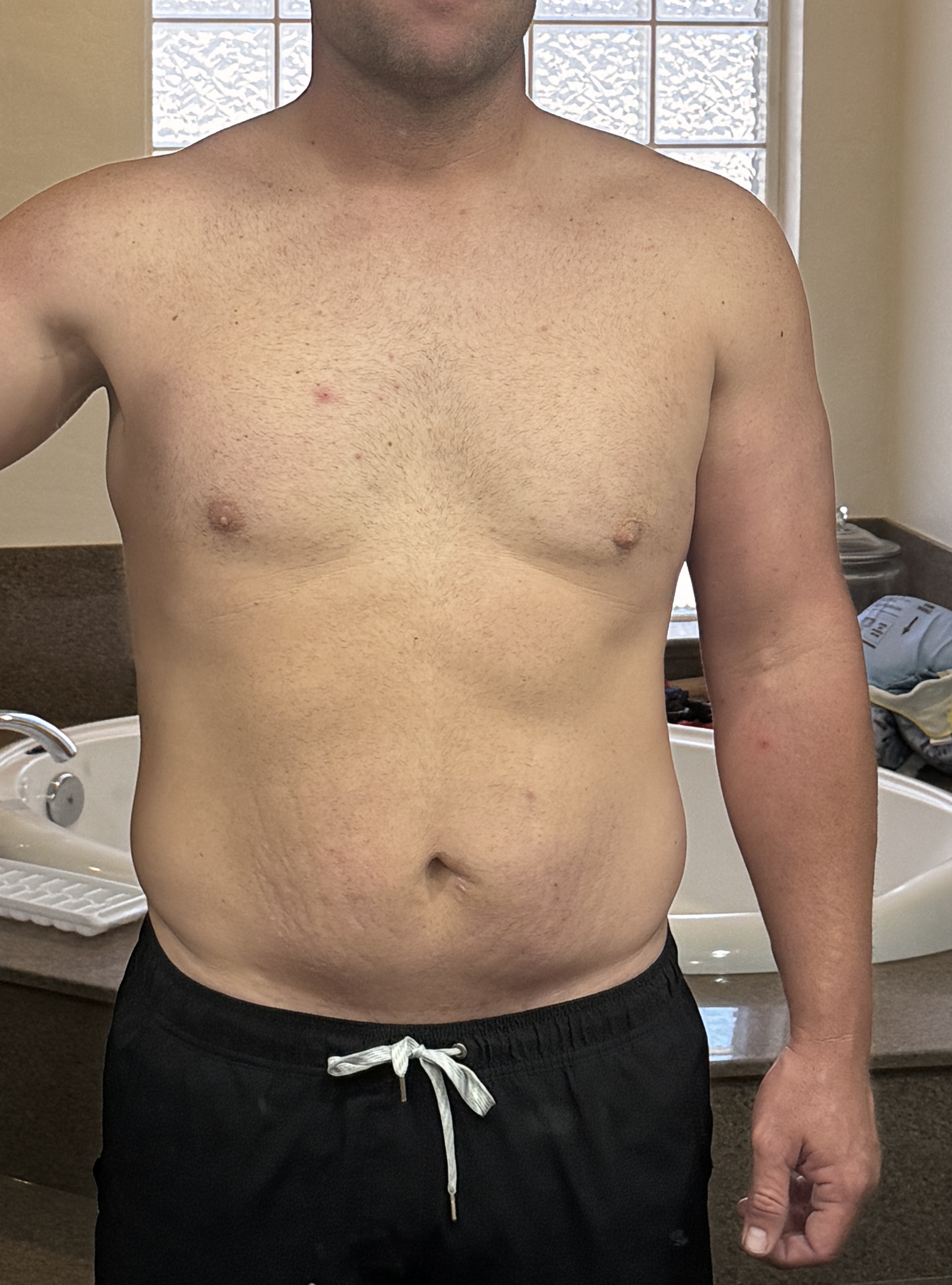 Patient 3 after photo