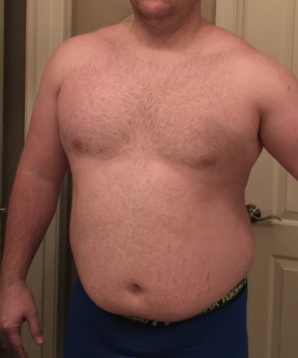 Patient 3 before photo